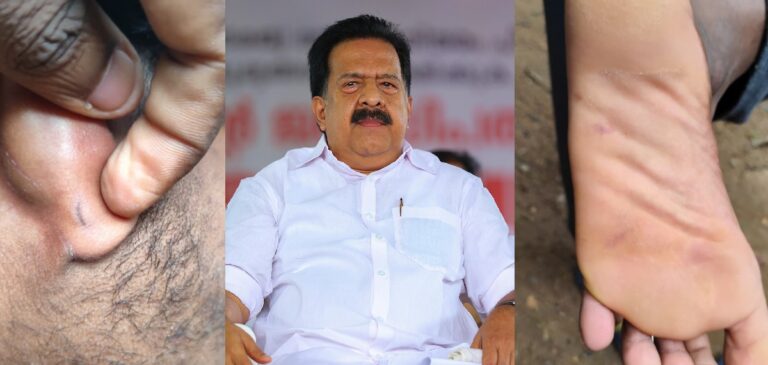 pathanamthitta-police-attack